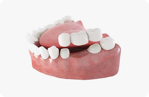 환자의 치아 색상, 모양, 교합을 반영한 개별 맞춤 디자인으로 자연스럽고 편안한 보철물을 가공하는 부산 영도 편한치과