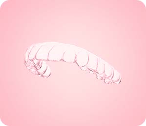 분석 데이터를 바탕으로 정밀 제작된 투명 교정 장치를 착용하여 본격적인 치아 교정을 시작하는 단계